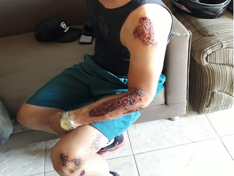 68-ciclista-sofre-acidente-ba-262-brumado-aracatu-03