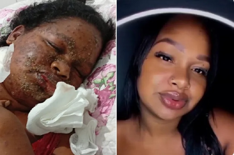Jovem de Brumado com síndrome rara está internada na UTI e família faz campanha para custear tratamento