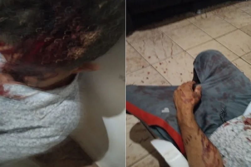 Brumado: Homem é espancado com pedaço de madeira e fica 24 horas desacordado após ataque de vizinho